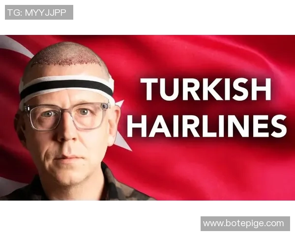 土耳其植发技术助力足球明星重塑自信与风采 土耳其植发技术助力足球明星重塑自信与风采